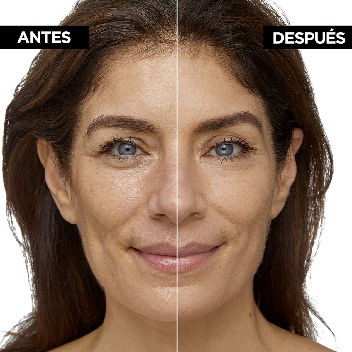 L'Oréal Paris Serum Rellenador Con Color, True Match, Tono 2-3 Light