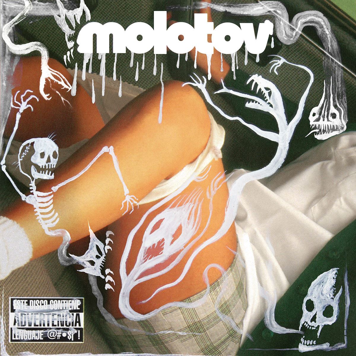Cd+ Dvd Molotov- Dónde Jugarán Las Niñas