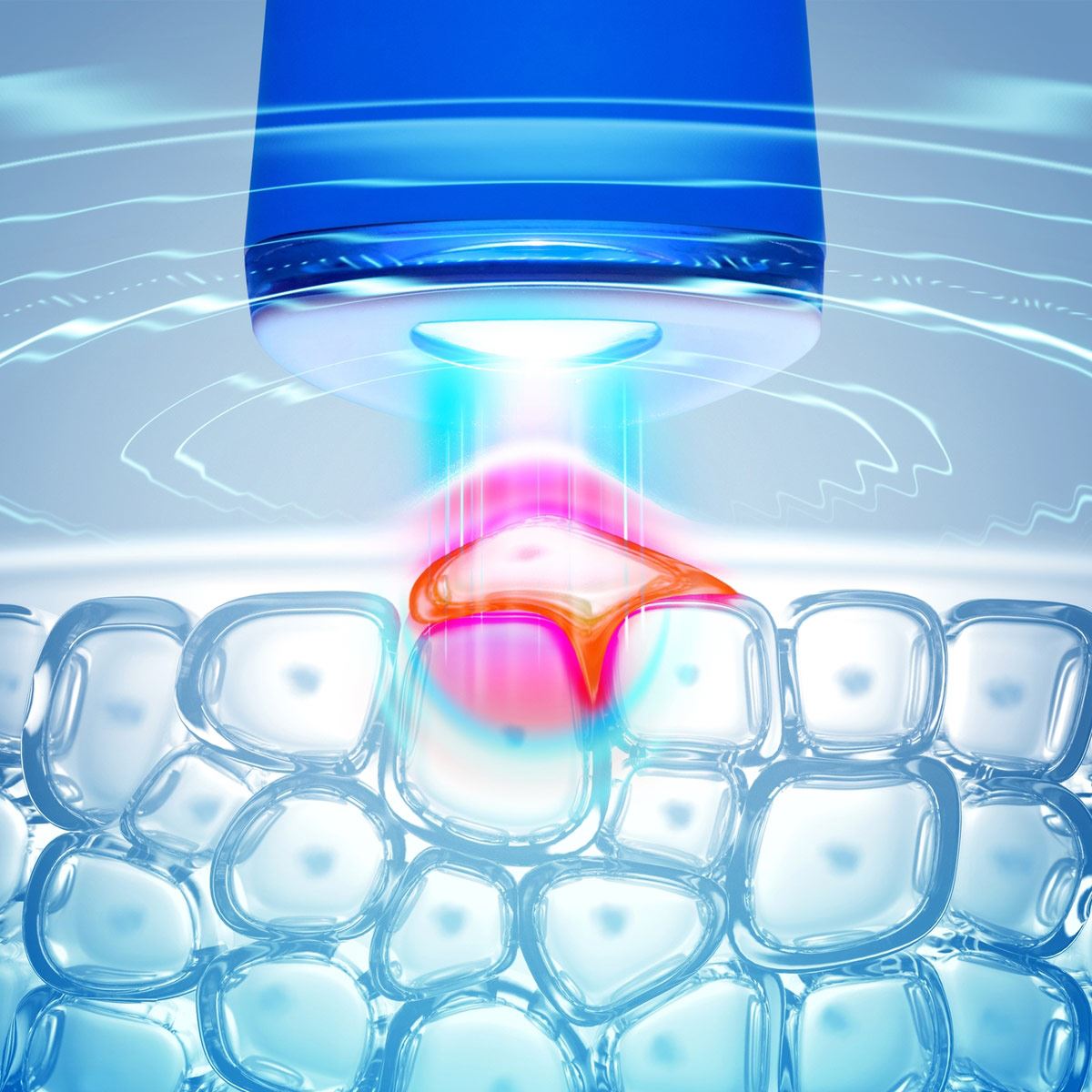 Dispositivo antiacné Foreo Espada Cobalt Blue