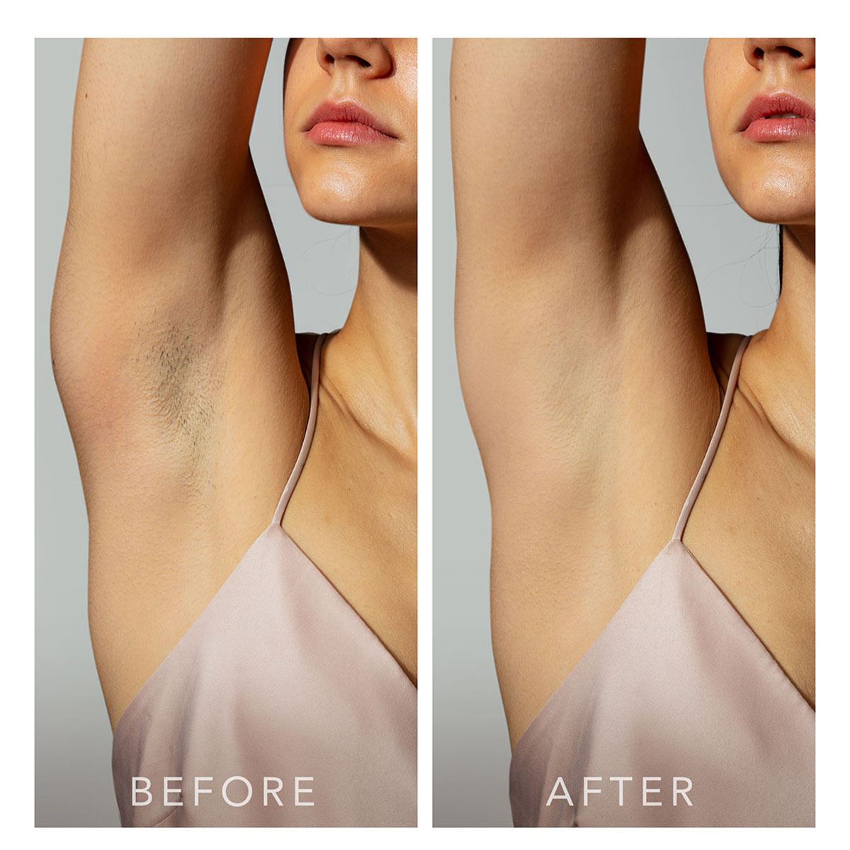 Depiladora de Luz Pulsada Foreo Peach 2 Mint