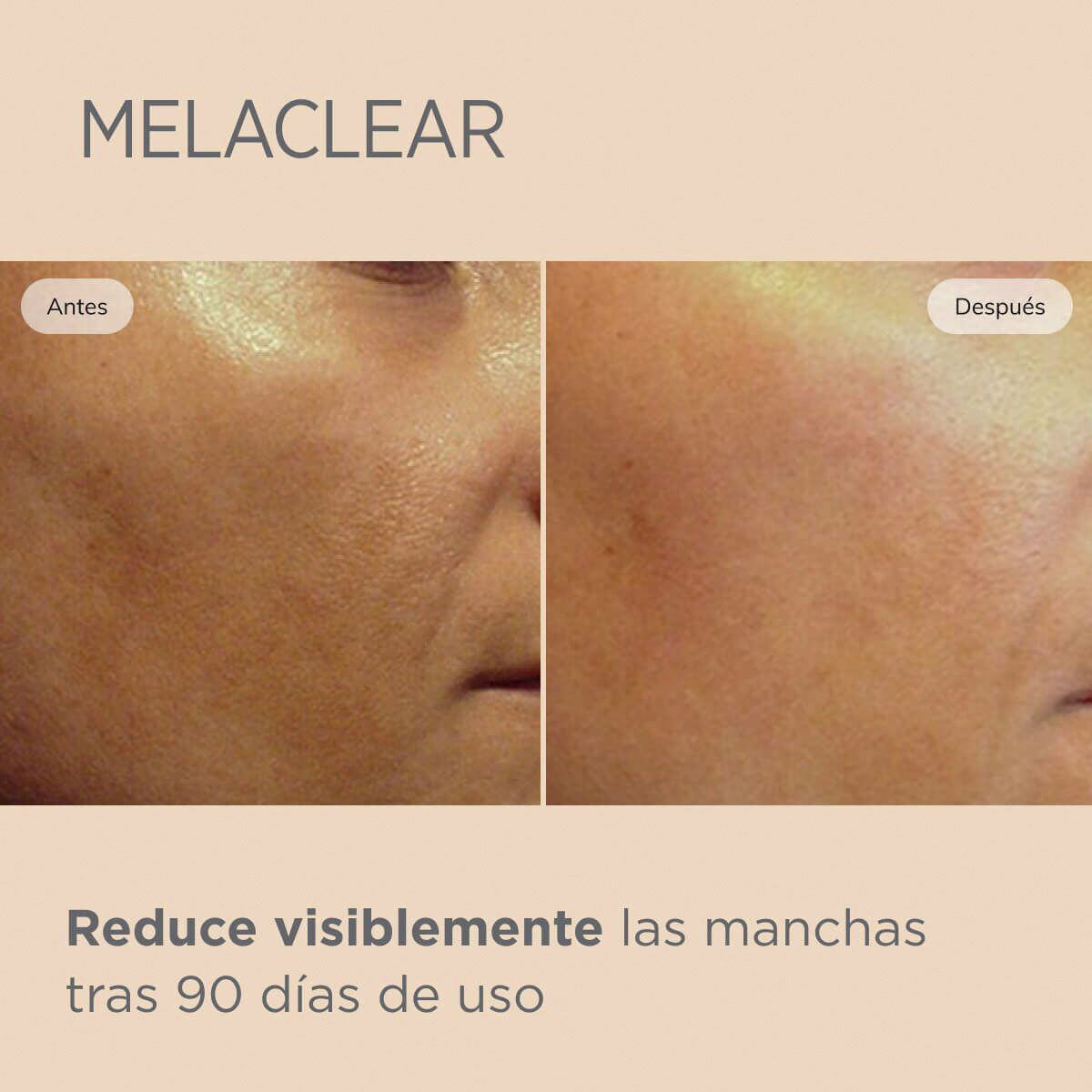 Isdinceutics Melaclear 15ml Serum Facial Antimanchas