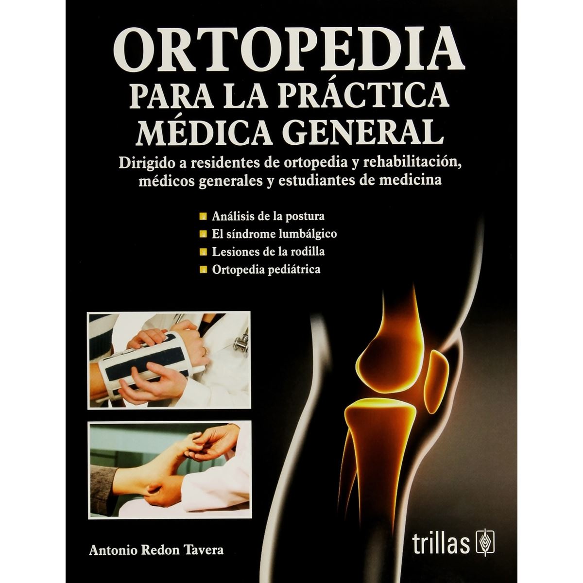 Ortopedia Para La Practica Medica General: Dirigido A Residentes De