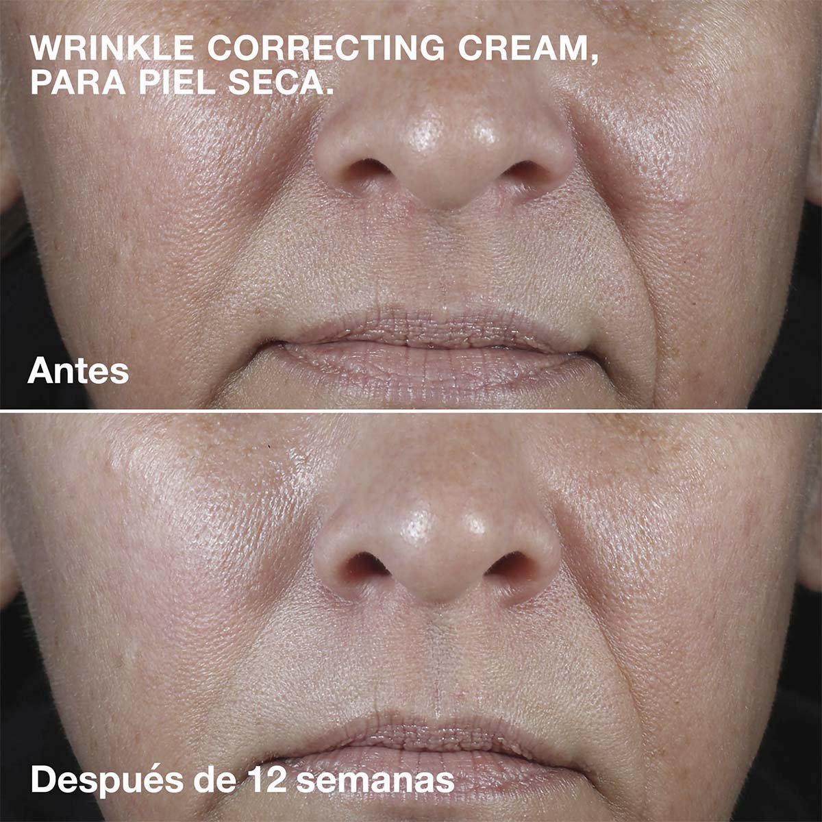 Crema Antiarrugas Clinique Smart Clinical Repair Wrinkle Correcting Cream Rich Cream