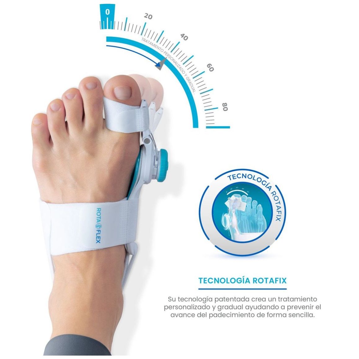 Rotaflex Tratamiento para Juanetes