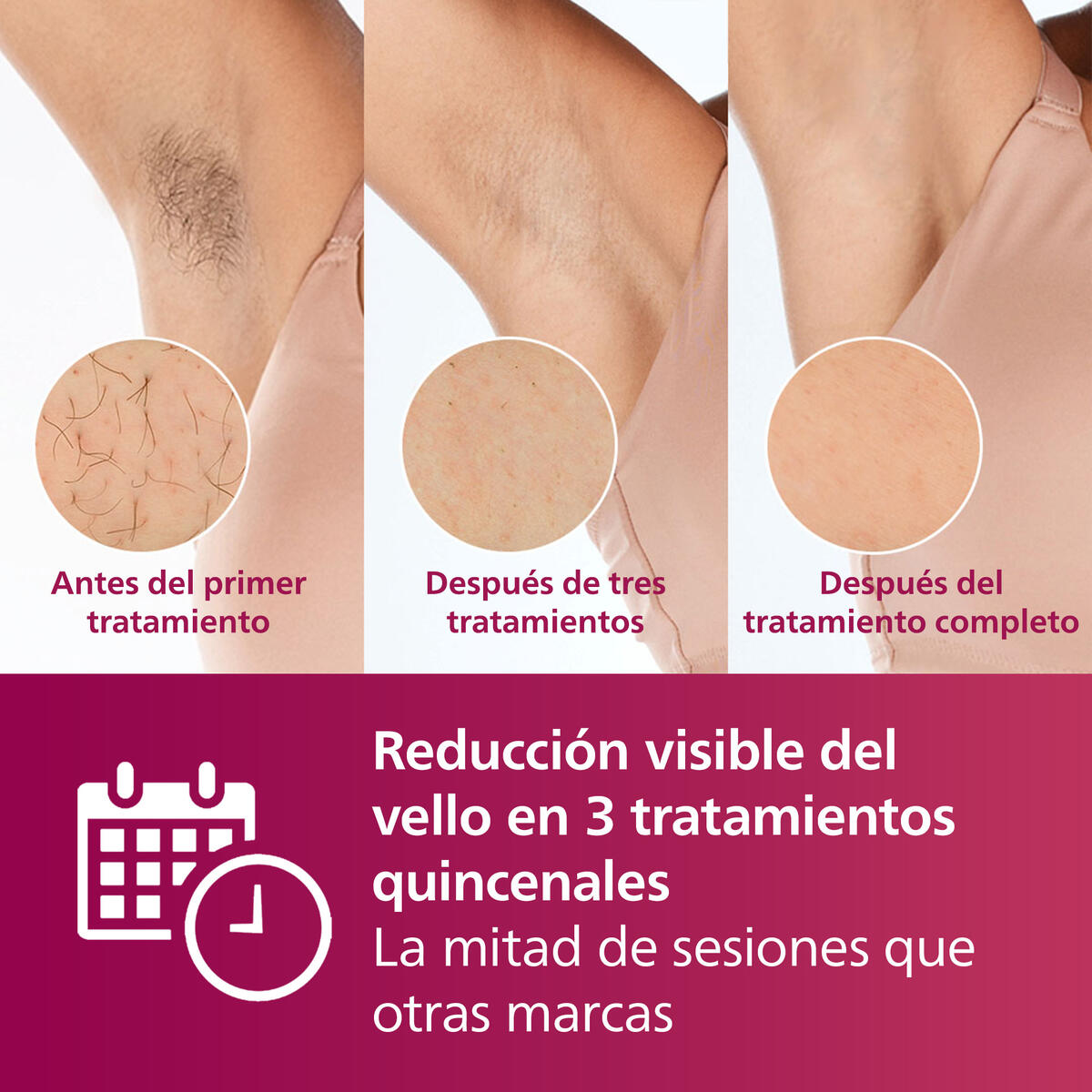 Depiladora Lumea Philips