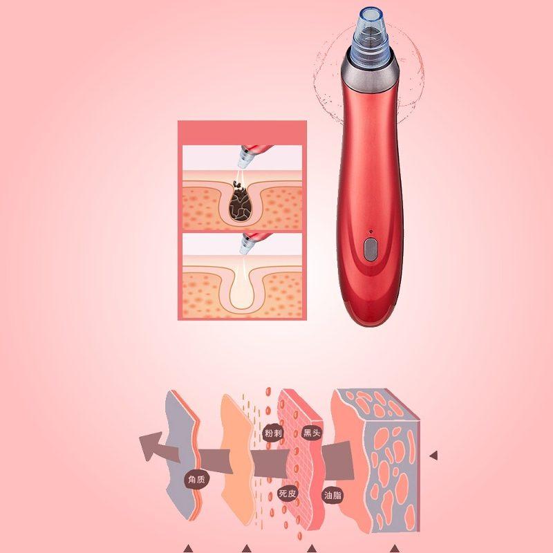 Limpiador Facial Poros Succión Puntos Negros Espinillas Acne Comedones Removedor de Imperfecciones