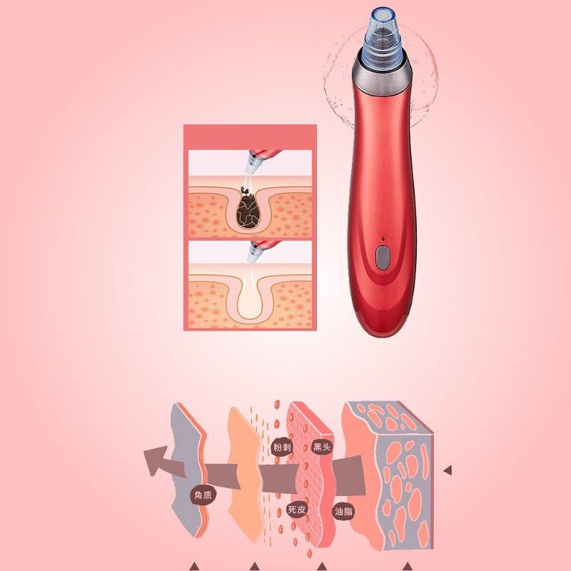 Limpiador Facial Poros Succión Puntos Negros Espinillas Acne Comedones Removedor de Imperfecciones