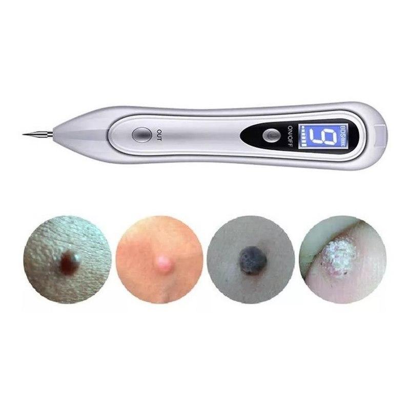 Cauterio Plasma Pen Removedor Verrugas Lunares Tatuaje Pecas Cauterizador Plasma