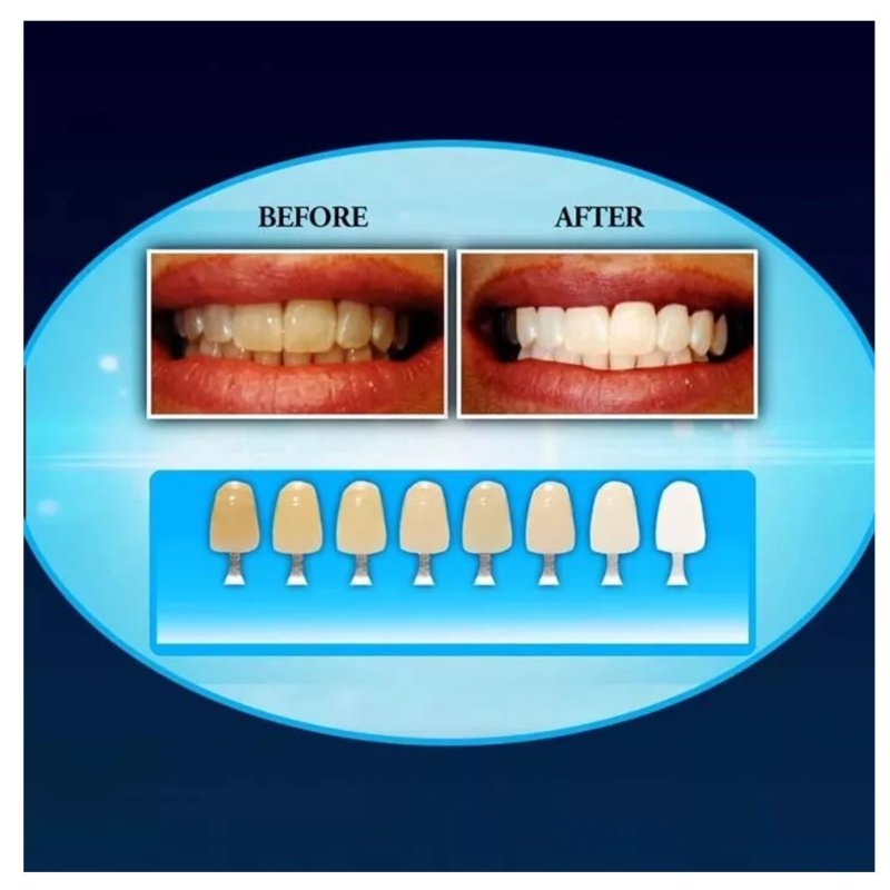 blanqueador dental luz led en 20 minutos