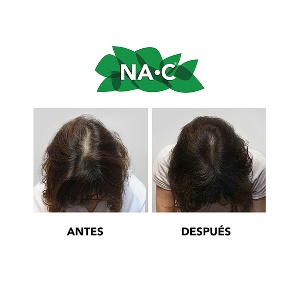 SHAMPOO NA-C 270 ML 