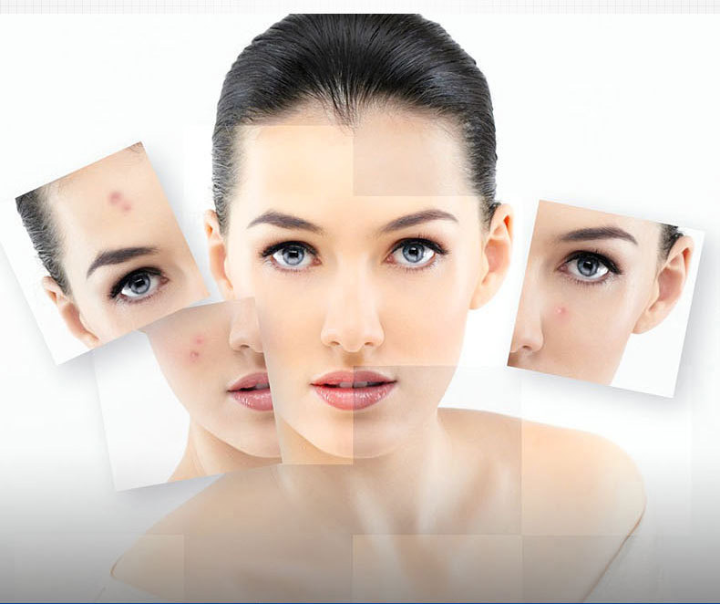 Mascarilla facial  Anti Acné con 10 piezas.