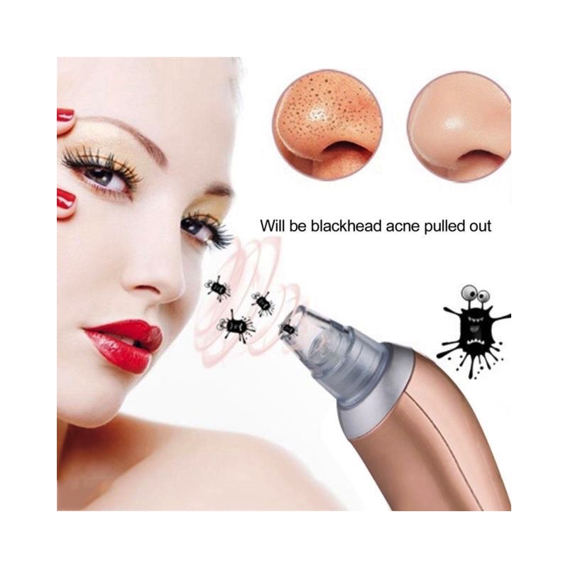 Máquina de Succión De Puntos Negros Espinillas Usb Recargable