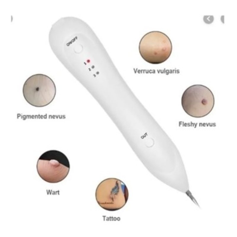 Quita Verrugas Corporal Y Genital Pecas Manchas + 5 Agujas