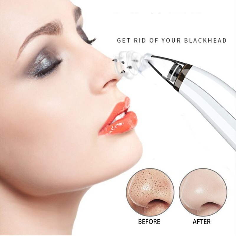 Limpiador Facial para Poros, Puntos Negros, Acne & Espinillas