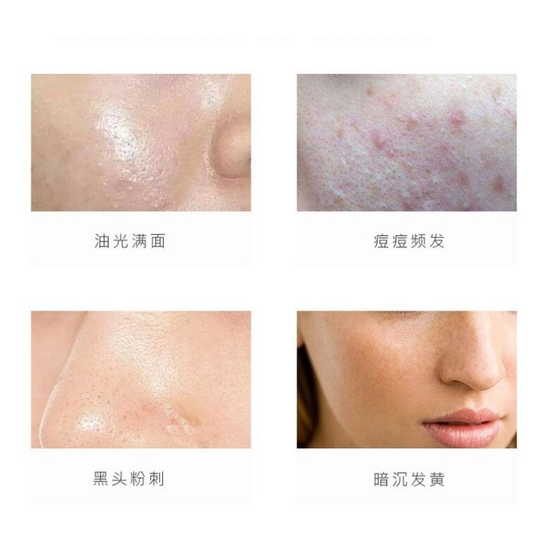 Set 3pz Jabón Limpiador Facial de Aloe Vera, Carbón Activado y Aminoácidos, LBP