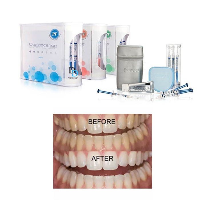 Kit Blanqueamiento Dental Opalescence (8 Jeringas) con estuche ULTRADENT