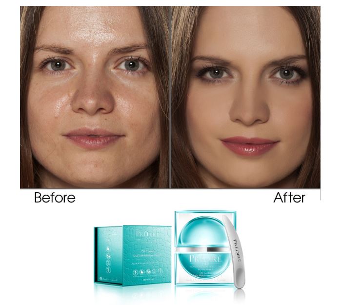 Crema Facial Humectante Control De Acné Prédiré 40ml