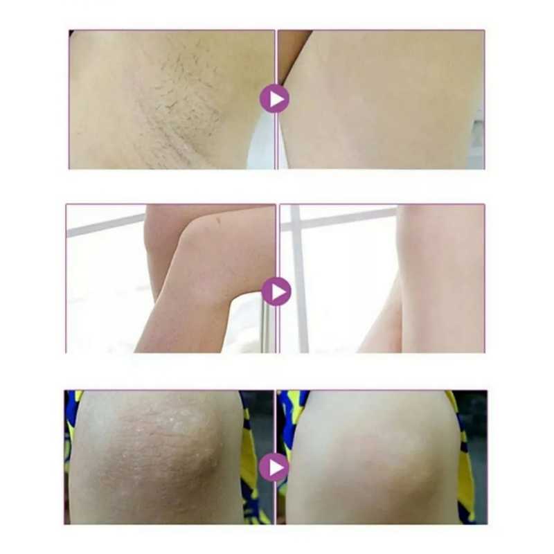 Crema Aclarante Corporal, Axilas y Zonas Dificiles Con Colageno y Leche Aichun Beauty