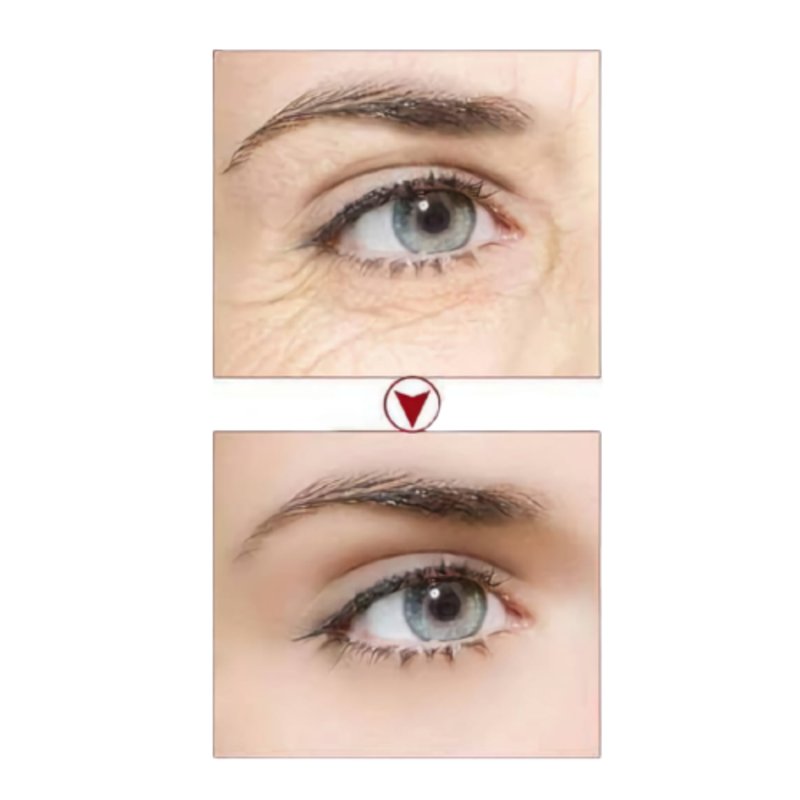 Serum Roll On Contorno de Ojos. Elimina Ojeras, Arrugas y Bolsas BioAqua