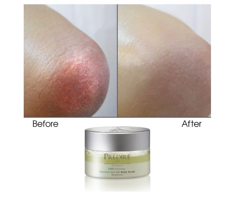 Exfoliante Corporal Prédiré Sea Salt Coconut 300g