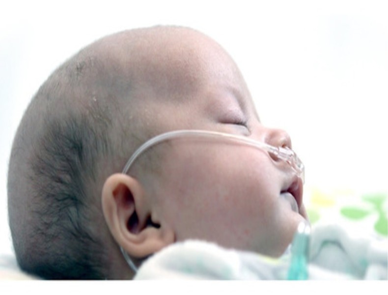 Puntas / Canula Nasal Neonatal 2.1m Para Oxigeno Westmed