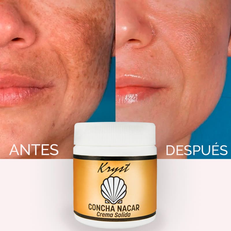 Kit 3 Crema Concha Nácar - Antiarrugas - Crema Aclarante - Antiedad