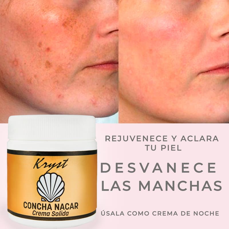 Kit 3 Crema Concha Nácar - Antiarrugas - Crema Aclarante - Antiedad