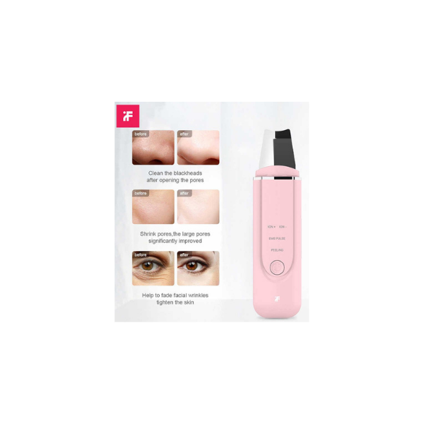 Limpiador Facial Electrico Exfoliador Xiaomi inFace Rosa