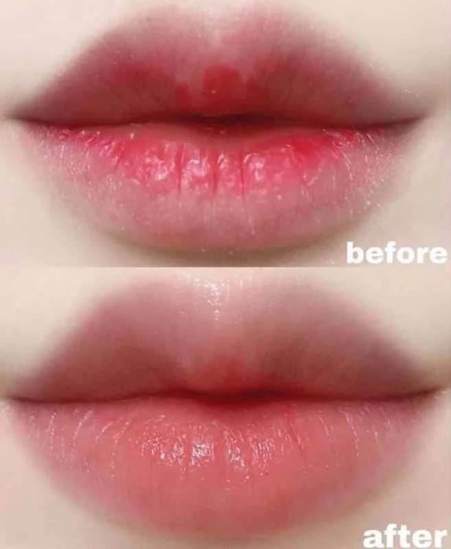 Mascarilla Coreana Para Labios De Hidrogel 1 Caja (20 Pz)