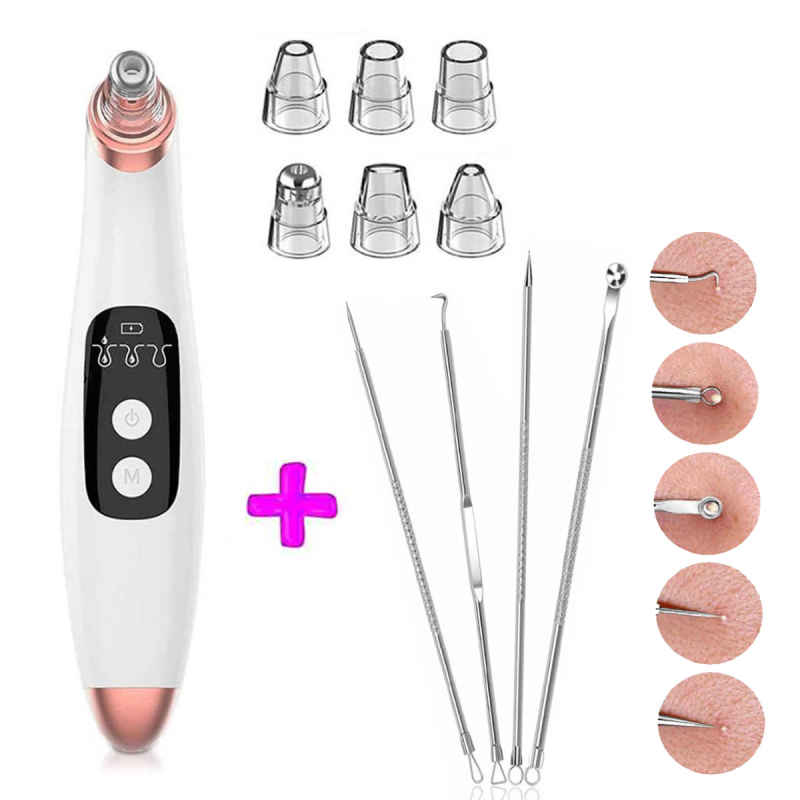 Removedor De Puntos Negros Recargable, Extractor, Succionador De Puntos Negros, Acné Y Espinillas Mas Kit De Herramientas Removedoras De Puntos Negros, Set Limpiador Facial Recargable