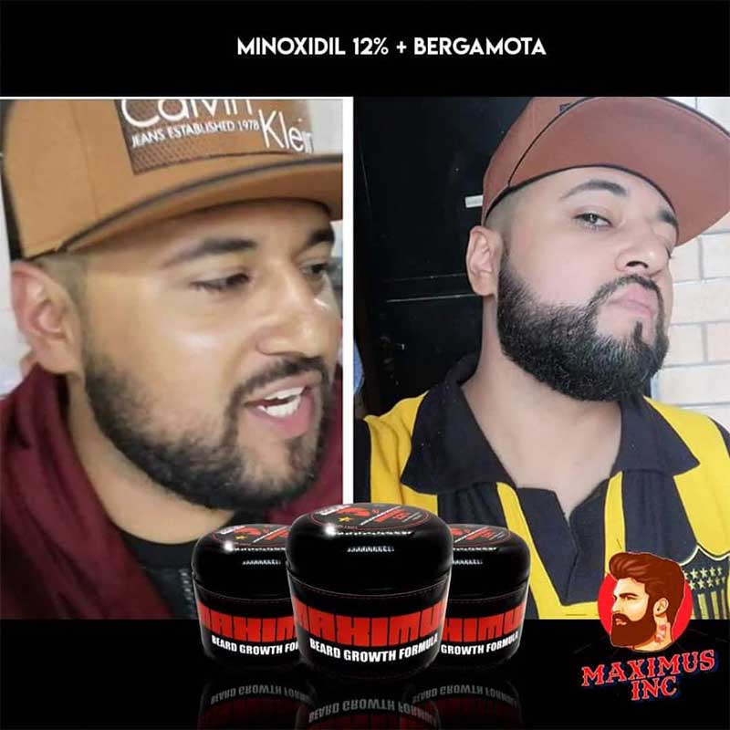 Bálsamo de minoxidil al 12% 4 oz Crecimiento de Barba y Bigote cerrar huecos | Haz crecer tu barba | Tapa huecos Sin tapar poros 