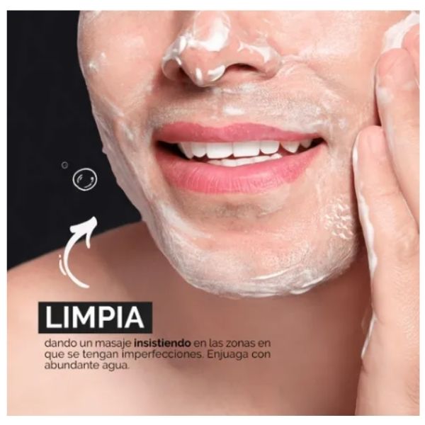 Asepxia Jabón Carbón Detox 100g Limpia tu piel