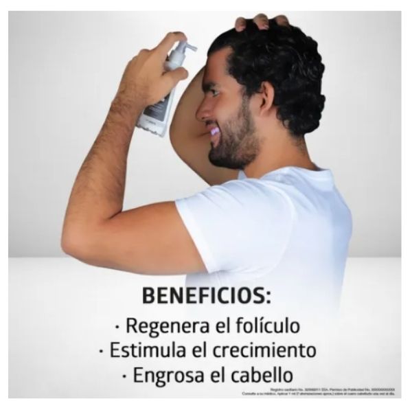 Sistema Gb Solución Alopecia 60 Ml. Minoxidil 5%