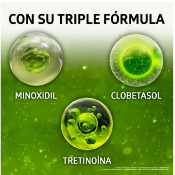 Sistema Gb Solución Alopecia 60 Ml. Minoxidil 5%