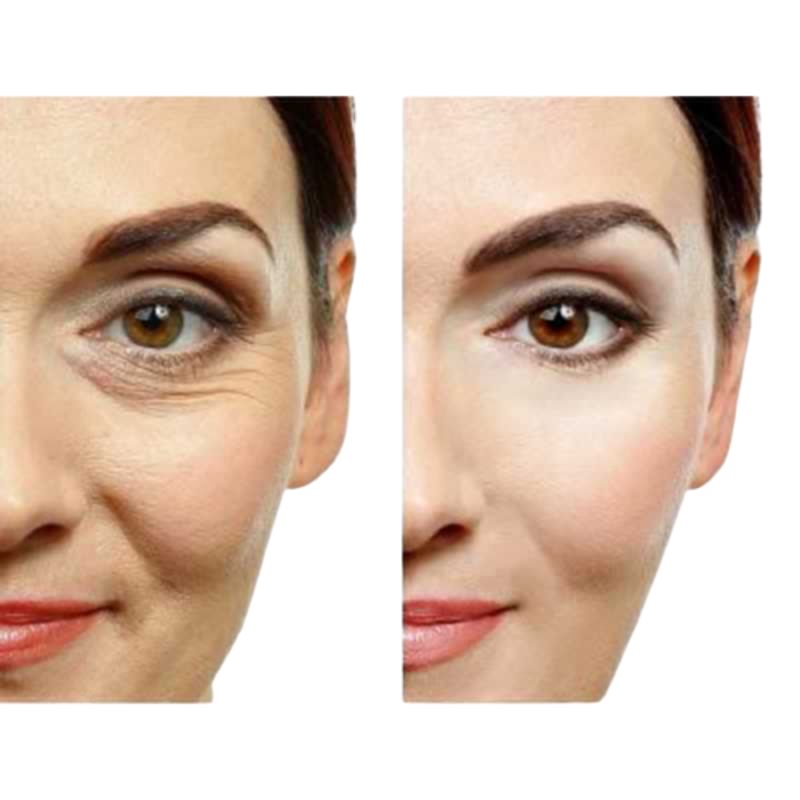 Serum Para Reducir Poros, Arrugas y Lineas de Expresion con Acido Hialuronico BioAqua