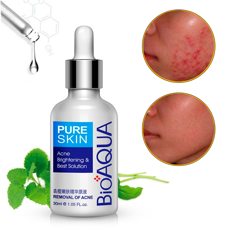 Bioaqua Serum Pure Skin Retira Acné Y Espinillas Limpieza Facial