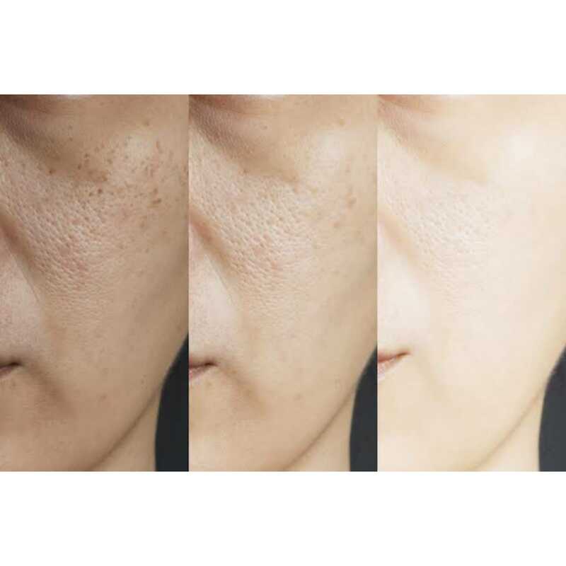 Serum Para Reducir Poros, Arrugas y Lineas de Expresion Con Rosa Mosqueta 24K Rose Gold