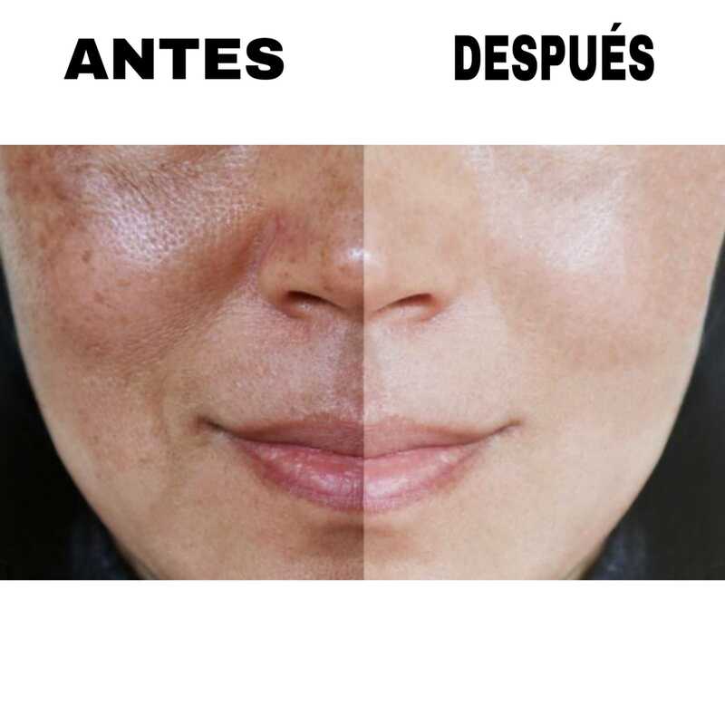 Serum Para Reducir Poros, Arrugas y Lineas de Expresion Con Rosa Mosqueta 24K Rose Gold