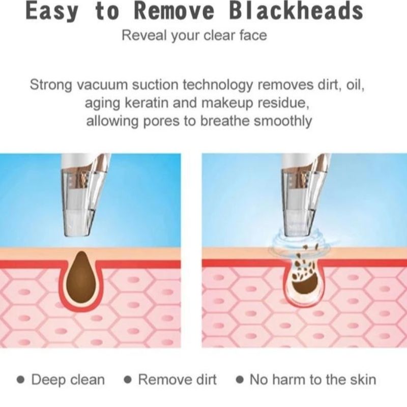Extractor de Puntos Negros, LBP, Dispositivo de Belleza Facial, Exfoliador