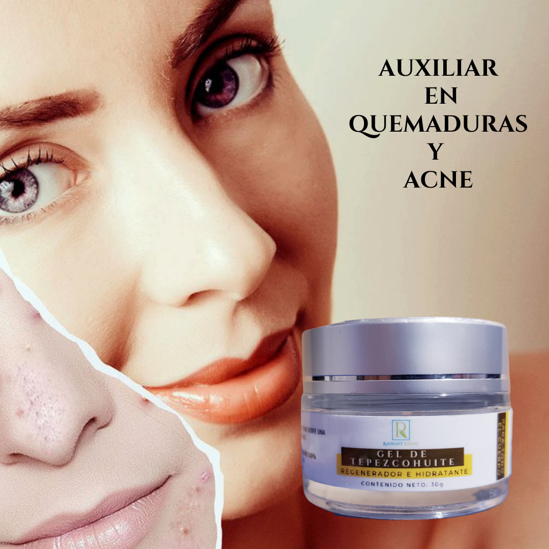 Gel Corporal de Tepezcohuite, Hidrata a Profundidad, Antiacné