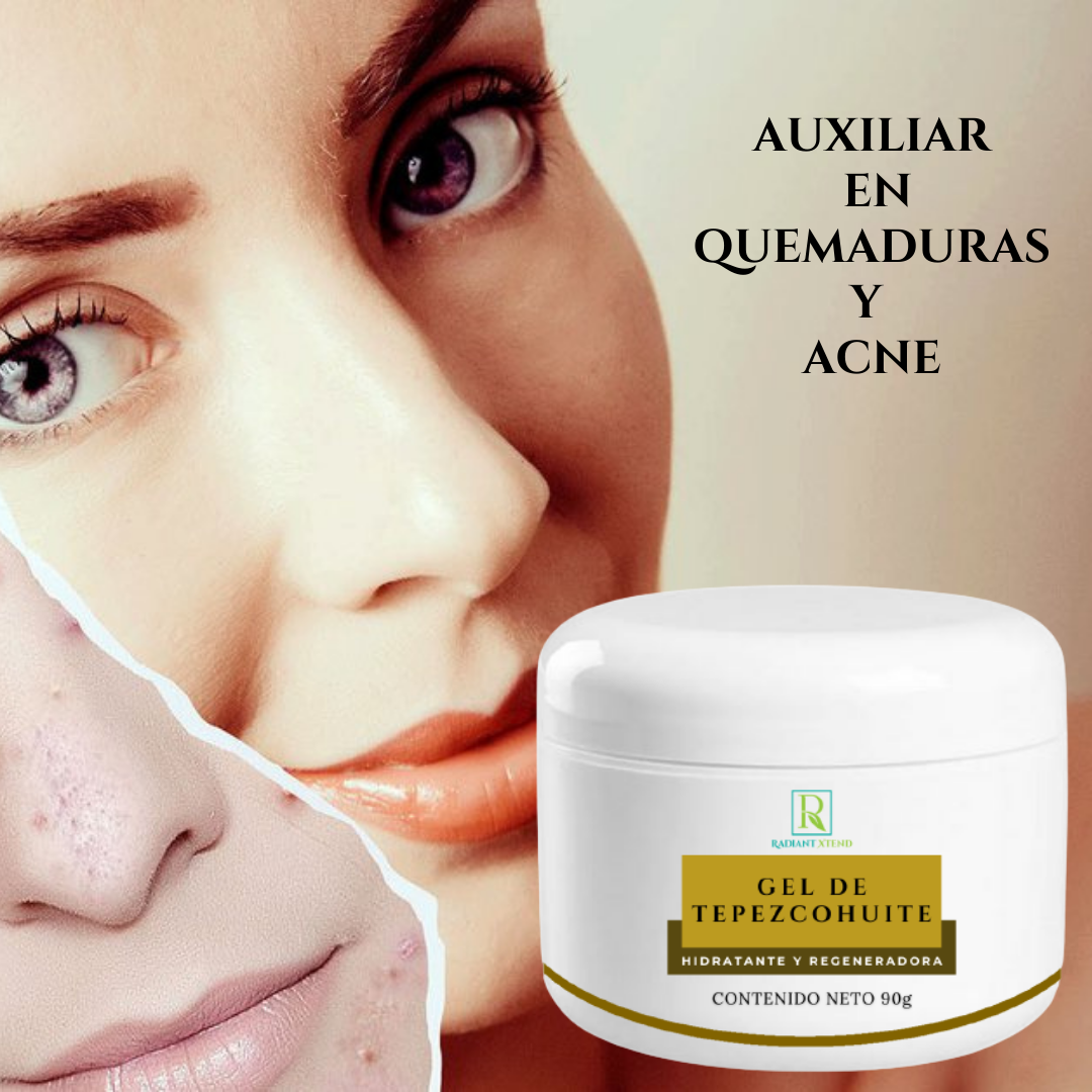 Crema anti-acné de tepezcohuite