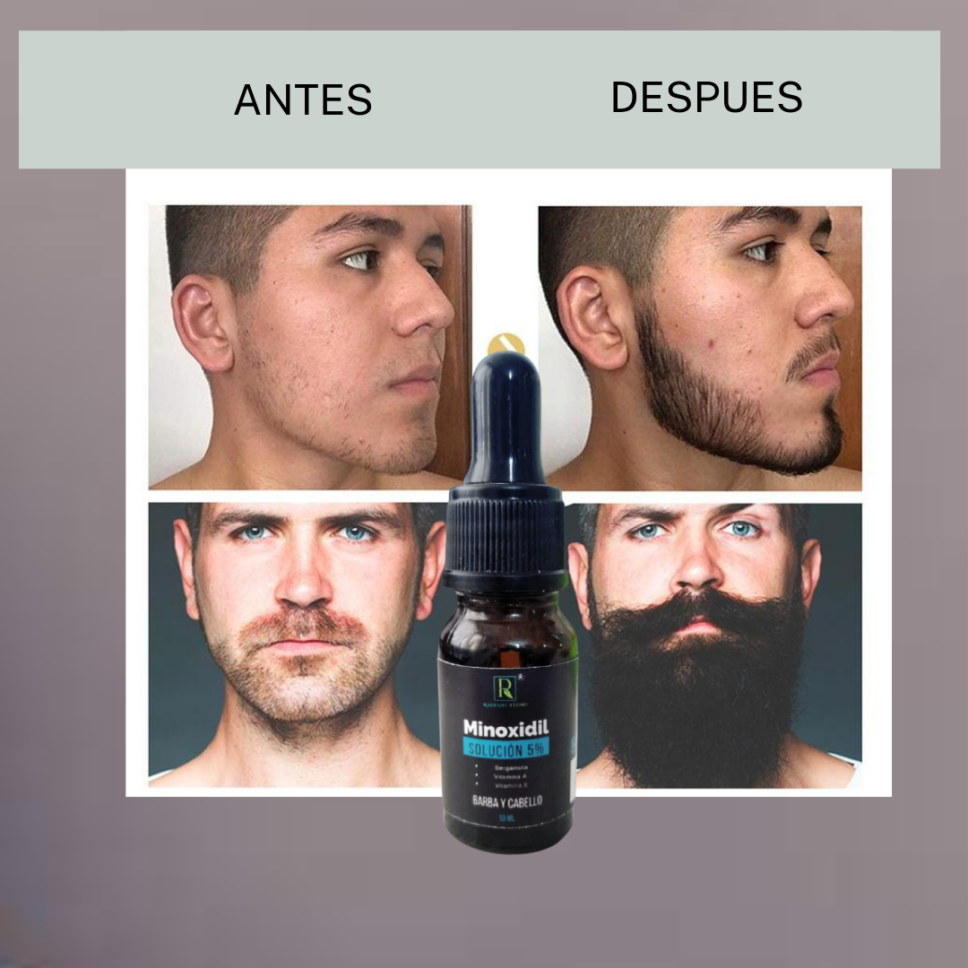 Minoxidil 5% Solución Caída Del Cabello 10 ML 100% Efectivo