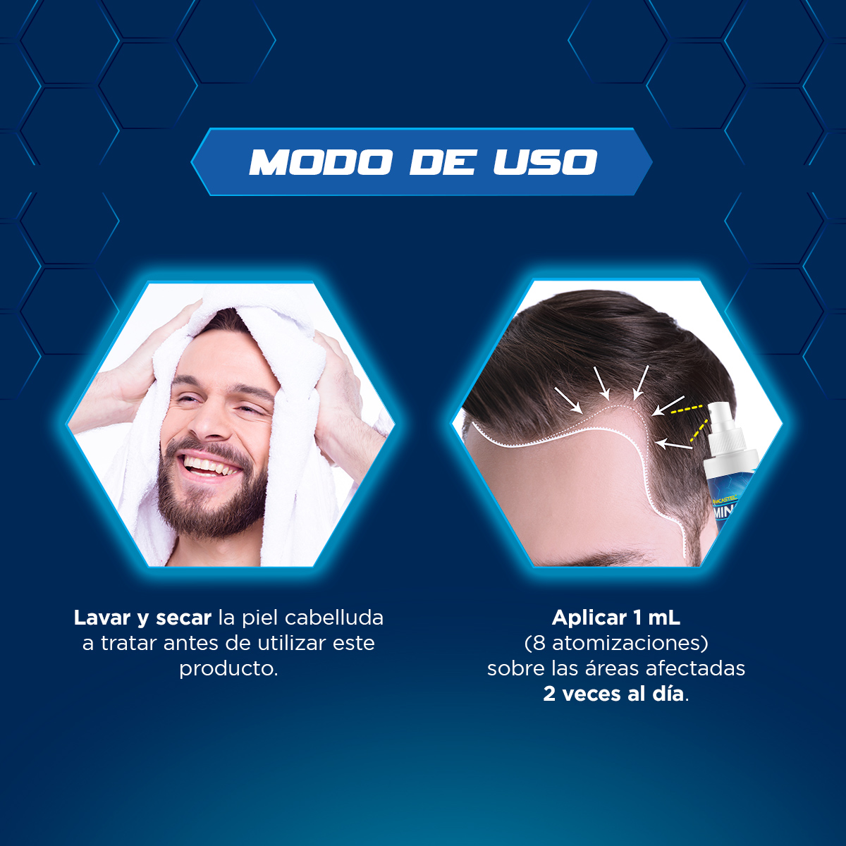 Tratamiento Cabello Y Barba Minoxidil 5% Frasco 60ml 