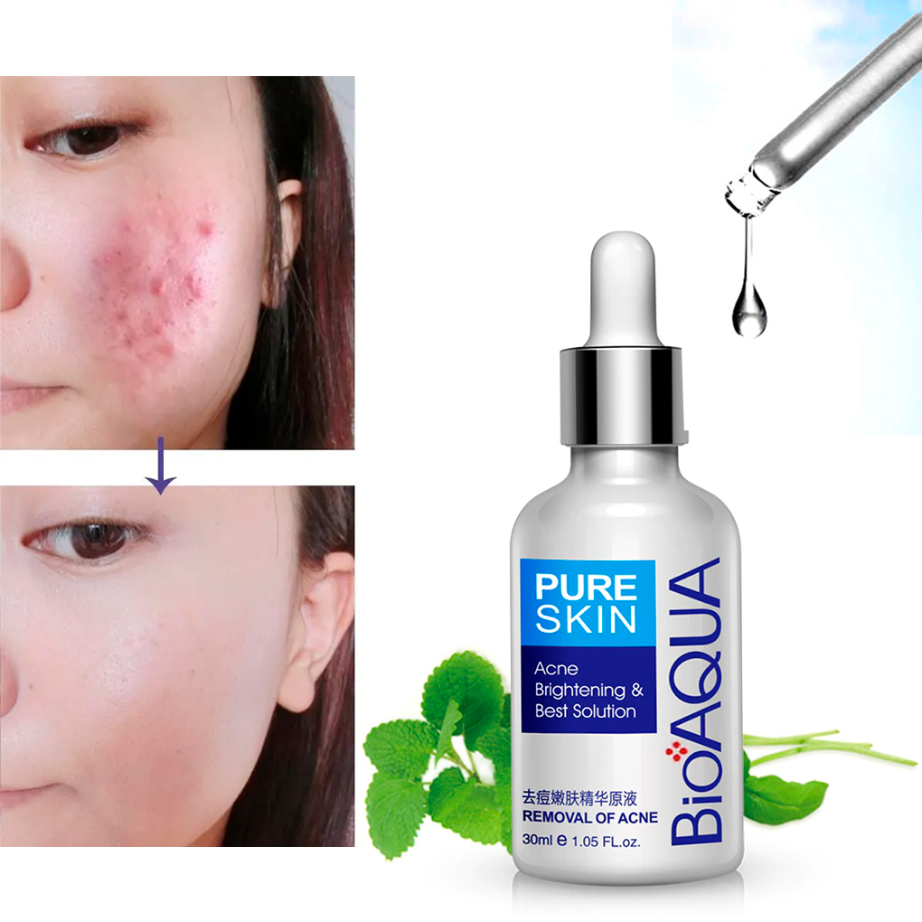 Bioaqua Serum Pure Skin Retira Acné Y Espinillas Limpieza Facial 