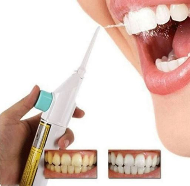 Irrigador Dental Para Limpieza Bucal Brakets Presión C/ Agua
