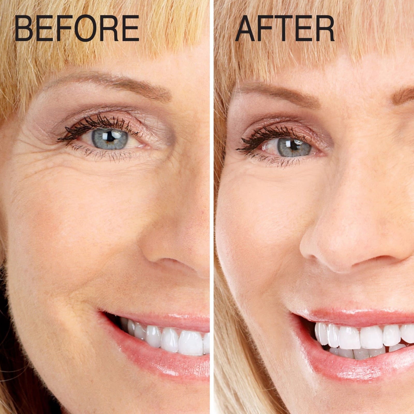 Suero facial  de colágeno 1.75fl(52ml) 