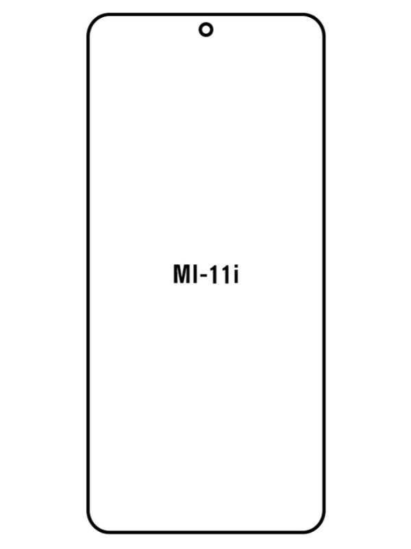 Jeco 99F Kit de Mica Hidrogel AZUL Frontal+Trasera XIAOMI MI 11i