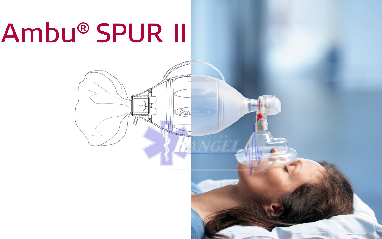 KIT 3 RESUCITADORES BOLSA VALVULA MASCARILLA AMBU SPUR II ADULTO, PEDIATRICO Y NEONATAL