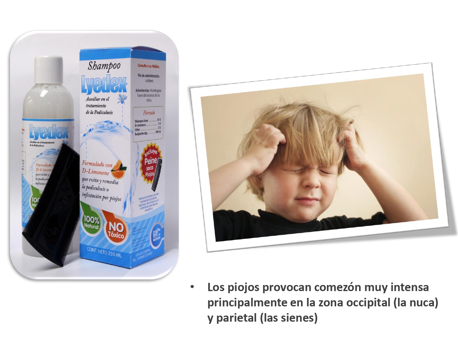 LYEDEX Shampoo auxiliar en el control de piojos, de uso diario