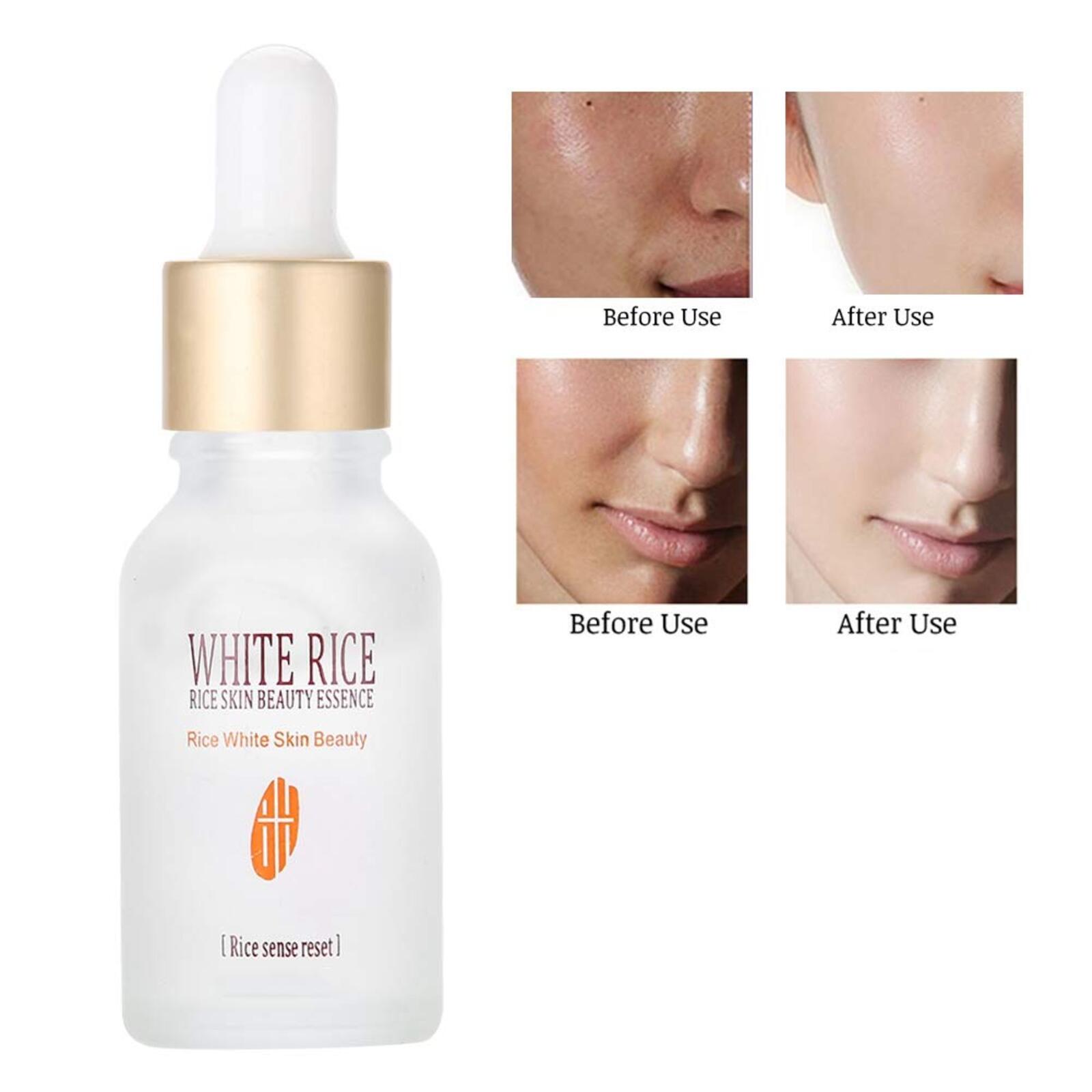 Set Facial Ácido Hialurónico Crema y Serums Rorec Hydra B5 Anti Arrugas Anti Manchas Cierra Poros Hidratante